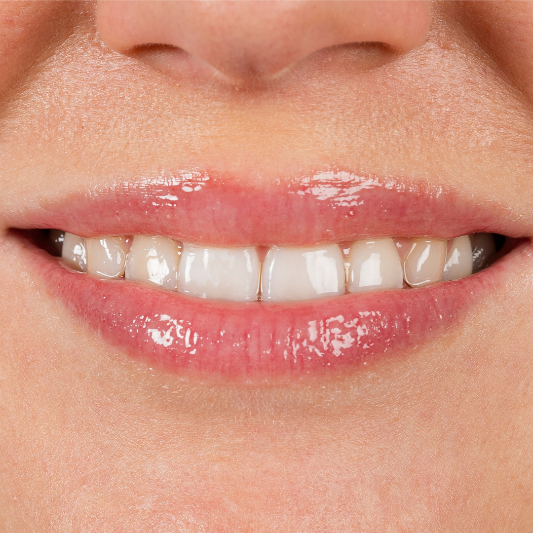 Gloss à lèvres booster d'hydratation