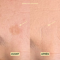 Rituel Anti-Taches